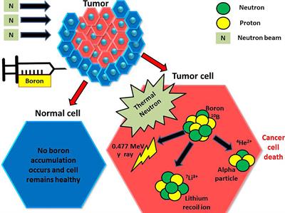 Frontiers | Boron Neutron Capture Therapy: A Review of Clinical